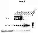 Fig. 05 - Method for inhibiting hyperpigmentation