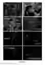 Fig. 05 - OLFACTORY STEM CELLS AND USES THEREOF