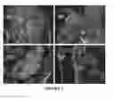 Fig. 08 - OLFACTORY STEM CELLS AND USES THEREOF