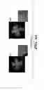 Fig. 09 - METHOD FOR MODULATING ANGIOGENESIS USING FIBROMODULIN