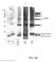 Fig. 08 - Molecular Antigen Array