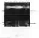 Fig. 08 - Nucleic Acid Encoding TGEV and PRRSV Sequences for Improved Expression of PRRSV Sequences