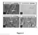 Fig. 04 - Elastin stabilization of connective tissue