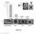 Fig. 05 - Elastin stabilization of connective tissue