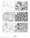 Fig. 07 - Nanostructure surface coated medical implants and methods of using the same