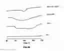 Fig. 07 - Sustained-release drug carrier composition
