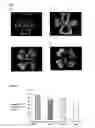 Fig. 02 - ANGIOGENESIS REGULATING COMPOSITION AND METHOD FOR REGULATING ANGIOGENESIS