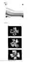 Fig. 03 - ANGIOGENESIS REGULATING COMPOSITION AND METHOD FOR REGULATING ANGIOGENESIS