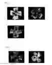 Fig. 04 - ANGIOGENESIS REGULATING COMPOSITION AND METHOD FOR REGULATING ANGIOGENESIS
