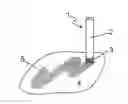 Fig. 01 - METHOD FOR APPLYING A FLUID ONTO A SUBSTRATE