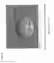 Fig. 08 - Method of fabricating a membrane having a tapered pore