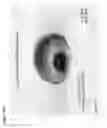 Fig. 12 - Method of fabricating a membrane having a tapered pore