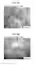 Fig. 05 - SHRINK RESISTANT MICROPOROUS MEMBRANE AND BATTERY SEPARATOR