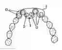 Fig. 01 - Orthodontic braces