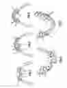 Fig. 02 - Orthodontic braces