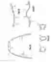 Fig. 04 - Orthodontic braces