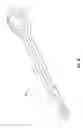 Fig. 02 - MULTI-ROOTED TOOTH EXTRACTION DEVICE