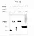 Fig. 14 - PNA DIAGNOSTIC USE