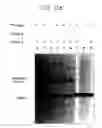 Fig. 15 - PNA DIAGNOSTIC USE