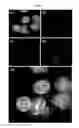 Fig. 02 - METHOD OF ANALYZING GENETICALLY ABNORMAL CELLS