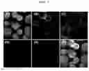 Fig. 06 - METHOD OF ANALYZING GENETICALLY ABNORMAL CELLS