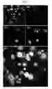 Fig. 07 - METHOD OF ANALYZING GENETICALLY ABNORMAL CELLS