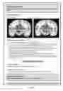 Fig. 15 - NEUROPSYCHIATRIC TEST REPORTS