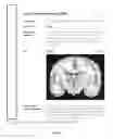 Fig. 20 - NEUROPSYCHIATRIC TEST REPORTS