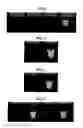 Fig. 07 - Method for Amplifying Nucleic Acid