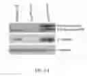 Fig. 02 - Method for detecting invasive microvesicles derived from tumor cells