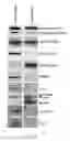 Fig. 09 - Method for detecting invasive microvesicles derived from tumor cells