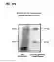 Fig. 102 - COMPOSITIONS AND METHODS FOR DEMONSTRATING SECRETORY IMMUNE SYSTEM REGULATION OF STEROID HORMONE RESPONSIVE CANCER CELL GROWTH