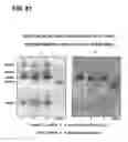 Fig. 82 - COMPOSITIONS AND METHODS FOR DEMONSTRATING SECRETORY IMMUNE SYSTEM REGULATION OF STEROID HORMONE RESPONSIVE CANCER CELL GROWTH