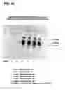 Fig. 89 - COMPOSITIONS AND METHODS FOR DEMONSTRATING SECRETORY IMMUNE SYSTEM REGULATION OF STEROID HORMONE RESPONSIVE CANCER CELL GROWTH