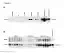 Fig. 02 - ENHANCED PRODUCTION OF PAPILLOMAVIRUS-LIKE PARTICLES WITH A MODIFIED BACULOVIRUS EXPRESSION SYSTEM