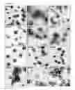 Fig. 04 - ENHANCED PRODUCTION OF PAPILLOMAVIRUS-LIKE PARTICLES WITH A MODIFIED BACULOVIRUS EXPRESSION SYSTEM