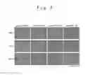 Fig. 04 - Culture methods of bone marrow stromal cells and mesenchymal stem cells, and manufacture method of graft cells for central nerve system diseases therapy