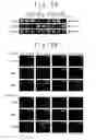 Fig. 06 - Culture methods of bone marrow stromal cells and mesenchymal stem cells, and manufacture method of graft cells for central nerve system diseases therapy