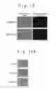 Fig. 13 - Culture methods of bone marrow stromal cells and mesenchymal stem cells, and manufacture method of graft cells for central nerve system diseases therapy