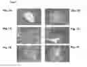 Fig. 02 - EMBRYONIC STEM CELLS AND NEURAL PROGENITOR CELLS DERIVED THEREFROM
