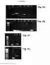 Fig. 04 - EMBRYONIC STEM CELLS AND NEURAL PROGENITOR CELLS DERIVED THEREFROM