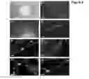 Fig. 07 - EMBRYONIC STEM CELLS AND NEURAL PROGENITOR CELLS DERIVED THEREFROM
