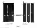 Fig. 03 - Methods of renal cancer detection
