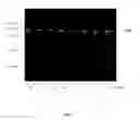 Fig. 08 - Methods of renal cancer detection