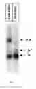 Fig. 11 - Method for generating aptamers with improved off-rates