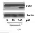 Fig. 04 - METHOD OF TREATING HEPATOCELLULAR CARCINOMA