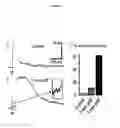 Fig. 02 - Methods of treating and preventing/reducing the likelihood of Mesial temporal lobe epilepsy (TLE)