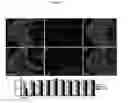 Fig. 10 - Methods of treating and preventing/reducing the likelihood of Mesial temporal lobe epilepsy (TLE)