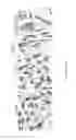 Fig. 15 - Methods for tumor treatment and adipogenesis differentiation