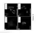 Fig. 16 - Methods for tumor treatment and adipogenesis differentiation